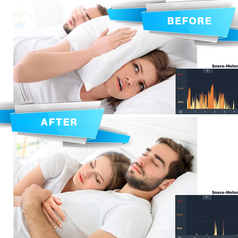 Anti-Snoring Mouthpiece