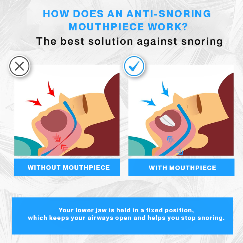Anti-Snoring Mouthpiece