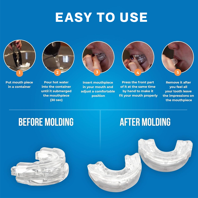 Anti-Snoring Mouthpiece