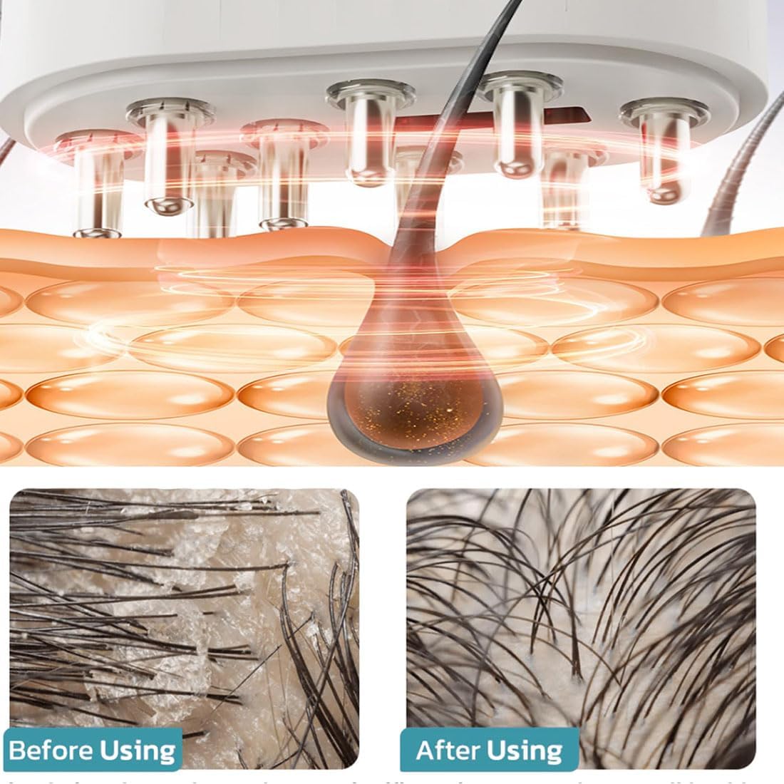 Appareil Follicle Activator 3.0