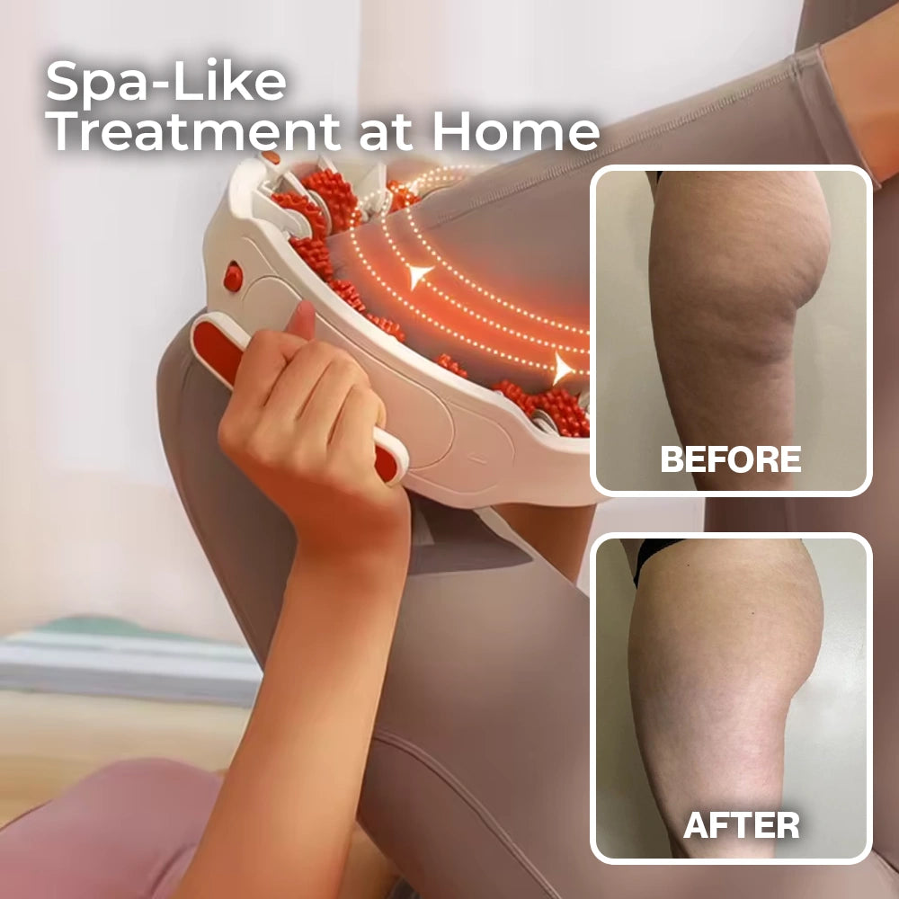 Anti-Cellulite Fascia Massager - Deep Tissue Massage Roller