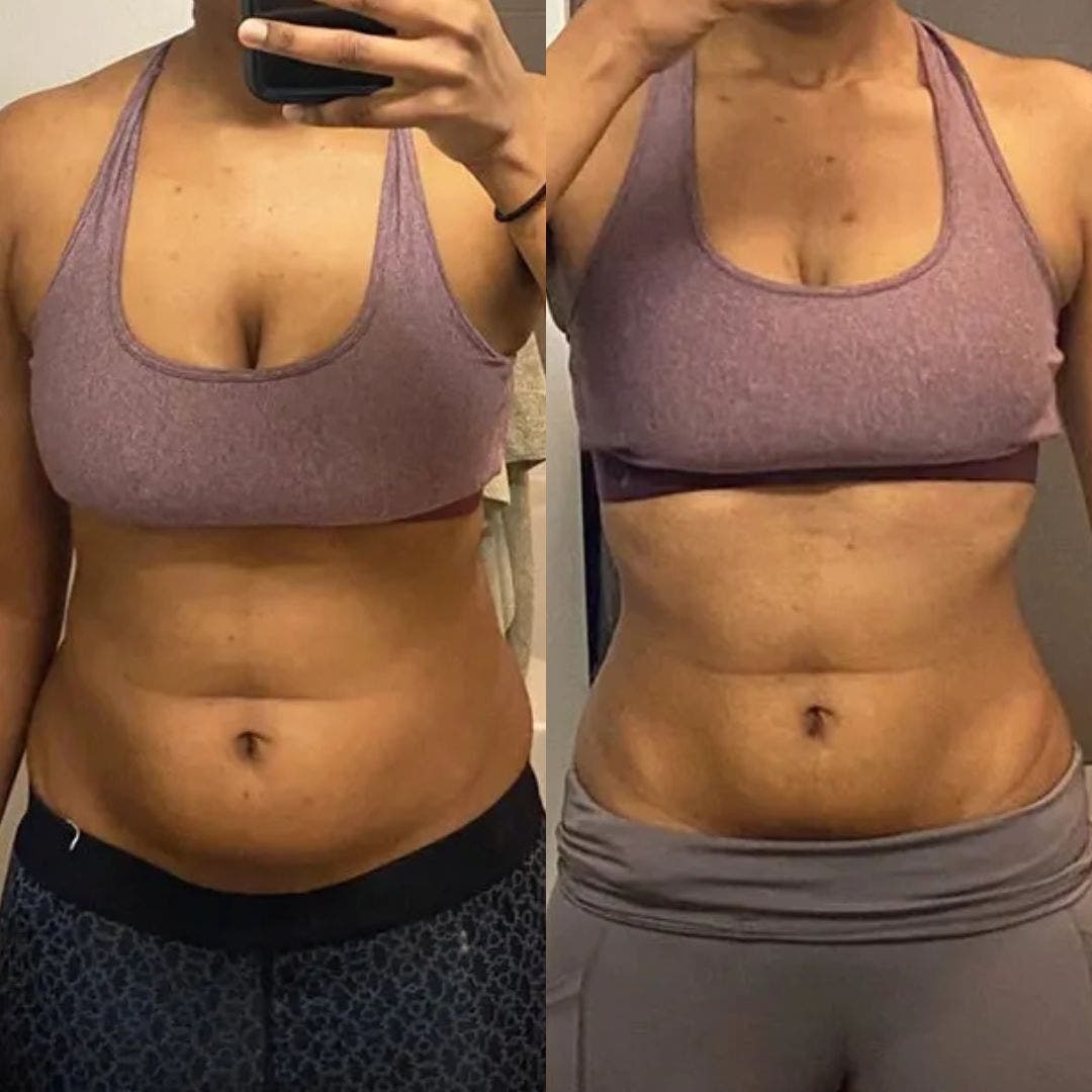 Necknix Ultrasonic Cavitation