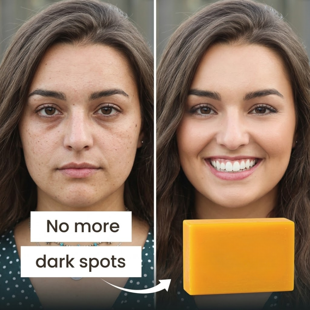 Necknix Brightening Soap - Turmeric & Kojic Acid