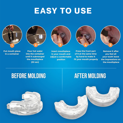 Anti-Snoring Mouthpiece