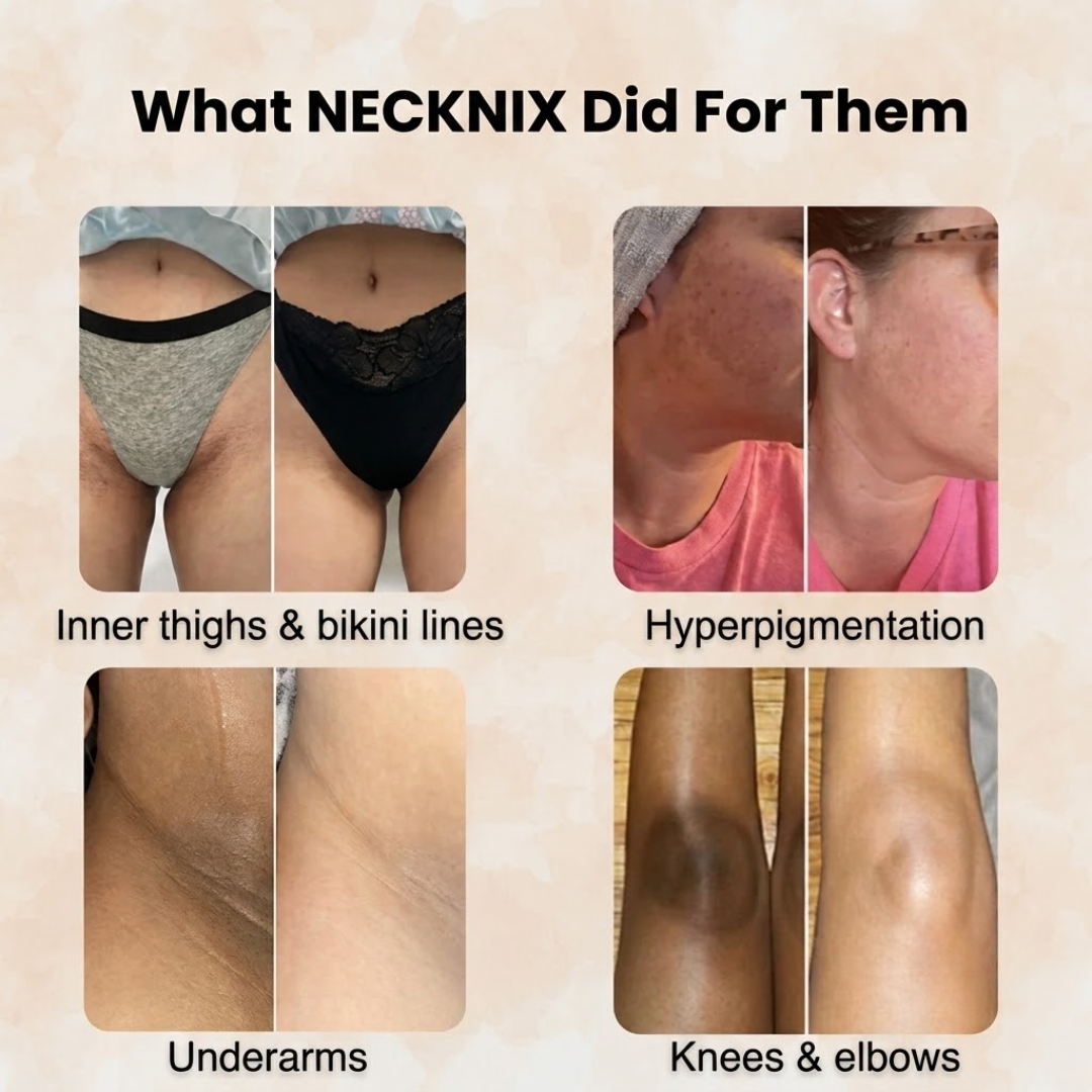 Necknix Brightening Soap - Turmeric & Kojic Acid