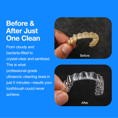 Necknix Dental Pod - Limpiador Ultrasónico