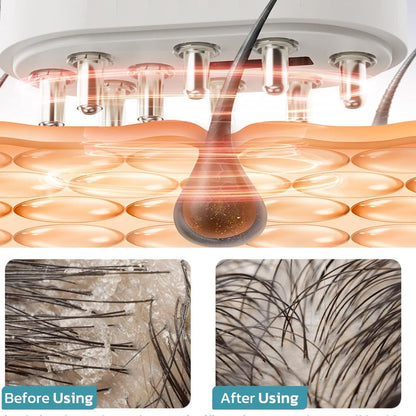 Appareil Follicle Activator 3.0