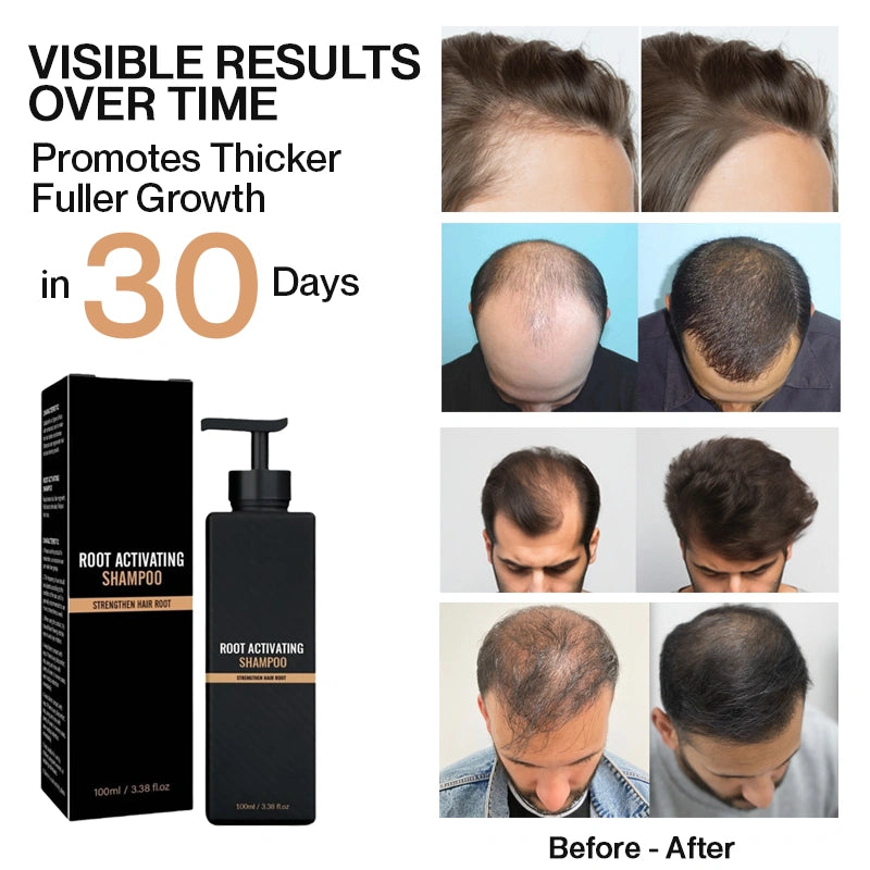 Root Activator Shampoo for Men Hair