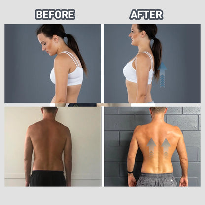Premium Adjustable Posture Corrector Brace